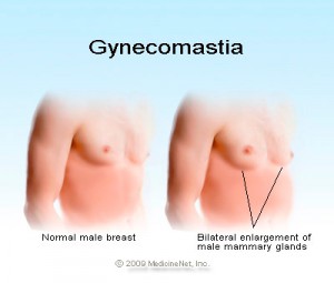 mens health gynecomastia