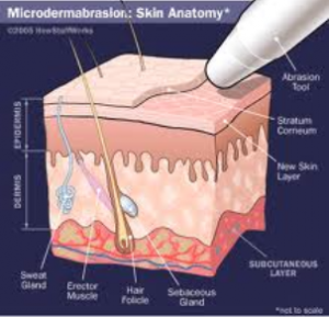 men's health microdermabrasion